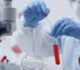 Un studiu realizat în România semnalează amenințarea unei variante bacteriene rezistente la antibiotice • Newsweek România